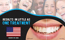 Bright White Smiles 44% Teeth Whitening Gel Syringe Refill Pack, Carbamide Peroxide, 5 Syringes (3ml),Tooth Whitener Formula by CozyNest Decor