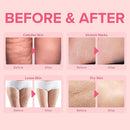 Anti Cellulite Body Firming Cream: Cellulite Remover for Legs & Inner Thigh- Skin Tightening Lotion for Womens' Booty, Stomach & Belly with Acetyl Hexapeptide-8 & Caffeine, 100 ML by TinyTreasures Baby Boutique