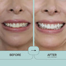 Prostrips - 12 Shades Whiter Teeth - 28 Enamel Safe REMINERALIZING Gentle Strips – 97% no Sensitivity by CozyNest Decor