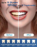 MySmile Teeth Whitening Gel Pen Refill Pack, 3 Non-Sensitive Teeth Whitening Pen, Deluxe Teeth Whitener Dental Grade Tooth Whitening Gel with Carbamide Peroxide for Home, 10 min Fast Result by CozyNest Decor