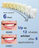 MySmile Teeth Whitening Strips Kit 14 Treatments with 28 LED Light - 10 Min Non-Sensitive Fast Whitening Teeth Enamel Safe Teeth Whitener - Helps to Remove Deep Stains by CozyNest Decor