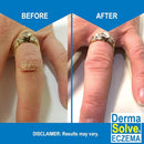 Dermasolve Eczema Relief Body Wash (2 Pack) | Protects, Moisturizes, and Repairs Skin - Kids, Babies & Adults - Steroid Free by TinyTreasures Baby Boutique