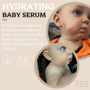 Roe Wellness- Baby Serum Hydrating Skincare Probiotic Protection | Hydrate, Soothe, Clean Ingredients & Safe For All Skin Babies, Infants, Toddlers & Kids (Power Serum) by TinyTreasures Baby Boutique