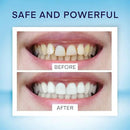 Teeth Whitening Pen (4 Pens) for Teeth Whitening, 40+ Uses, Effective, Painless, No Sensitivity, Travel-Friendly, Beautiful White Smile, Mint Flavor by CozyNest Decor