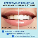 Venus Visage Award Winning Teeth Whitening Pen, 20+ Uses - Teeth whitening Kit Professionally formulated - Best Teeth whitening Gel Pen Teeth Whitener - Low Sensitivity (Mint) (0.07 Fl Oz (Pack of 2)) by CozyNest Decor