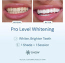 Snow Teeth Whitening Kit - Snow Teeth Whitening Serum and LED Mouthpiece Whitener, Formulated with Hydroxyapatite, Good for 6 Months - Wireless Kit with 3 Wands by CozyNest Decor
