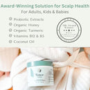 Yobee Ultra Gentle Soothing Scalp Mask - Dry Scalp Treatment Hair Mask Safe For Sensitive Baby Skin - Probiotic Infused - For Sensitive Scalp & Cradle Cap - For Babies, 4 fl oz by TinyTreasures Baby Boutique