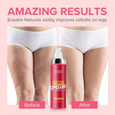 Enaskin Naturals Cellulite Remover for Legs & Anti Cellulite Cream - Skin Firming and Tightening Lotion for Inner Thigh ,Booty, Stomach & Belly, Body Firming Cream for Loose Skin, 100 ML by TinyTreasures Baby Boutique