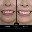 Prostrips - 12 Shades Whiter Teeth - 56 Enamel Safe REMINERALIZING Gentle Strips – 97% Had No Sensitivity - Bonus Size by CozyNest Decor