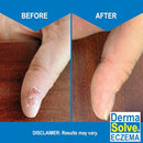 Dermasolve Eczema Relief Body Wash (2 Pack) | Protects, Moisturizes, and Repairs Skin - Kids, Babies & Adults - Steroid Free by TinyTreasures Baby Boutique