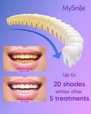 MySmile 4Pcs 35% Non-Sensitive Teeth Whitening Gel Refill Pack Kit for Whitening Teeth - Effective Painless Carbamide Peroxide Enamel Safety Mint Flavor Teeth Whitener(Not Include LED Mouth Tray) by CozyNest Decor