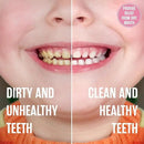 SprinJene Natural Kids Toothpaste, Bubblegum | Natural Children’s Toothpaste for Cavity Protection | Fluoride Toothpaste for Toddlers | 4 Pack by CozyNest Decor