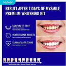 MySmile 7 Treatments Prefilled Teeth Whitening Trays Kit with 12% Hydrogen Peroxide Whiter Gel for Sensitive Tooth, Fast-Result Vegan Teeth Whitener Tooth Stain Remover, Mint Flavor by CozyNest Decor