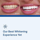 Snow Teeth Whitening Kit - Snow Teeth Whitening Serum and LED Mouthpiece Whitener, Formulated with Hydroxyapatite, Good for 2 Months - Wireless Kit with 1 Wand by CozyNest Decor
