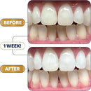 Lumineux Ultimate Whitening Kit Bundle - Contains Toothpaste, Mouthwash, Strips and Whitening Pen - Enamel Safe and Clinically Proven to Whiten Without The Sensitivity - Removes Coffee and Tea Stains by CozyNest Decor