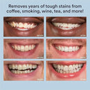 WHITE SMILE Teeth Whitening Kit, LED Light System, 35% Carbamide Peroxide 3 Gel Syringes, 10-Minute Treatment, Non-Sensitive Formula by CozyNest Decor
