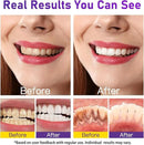 Teeth Whitening Powder - Teeth Whitening - Removes Stains - No Sensitivity - Toothpaste Power - Breath Freshener - for Coffee, Tea and Tobacco Stains 15g by CozyNest Decor
