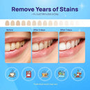 Whitebite Pro Upgraded Teeth Whitening Strips 28 Strips (14 Treatments) | Enamel-Safe | Deep Stains Removal | Non-Slip Design | Whitening Without Any Harm | Mint by CozyNest Decor