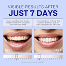 PearlSmile Niacinamide Hydroxyapatite Whitening Toothpaste – 10% Nano Hydroxyapatite + 5% Niacinamide – Strengthens Enamel, Remineralizes, Brightens Teeth – Fluoride-Free, Travel Size, 4.2oz (120g) by CozyNest Decor