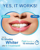 MySmile Non-Sensitive Teeth Whitening Pen Mint Gel Enamel Safety 8ML 30+ Treatments Fast Remove 20 Years of Stains Care Oral Bright Smile Alternative Teeth Whitening Strips by CozyNest Decor