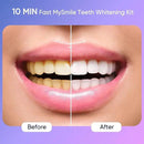 MySmile Deluxe 10 Min Teeth Whitening Kit with 28 LED Light, 35% Carbamide Peroxide Teeth Whitening Gel, Helps Remove Years of Stains from Coffee, Soda, Wines, Smoking, Food by CozyNest Decor