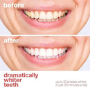 AquaSonic Professional Teeth Whitening Strips - Enamel Safe Teeth Whitening with Hydrogen Peroxide - Easy to Use, Non-Slip, Affordable & Effective (Watermelon) by CozyNest Decor