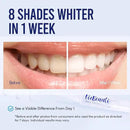 VieBeauti Teeth Whitening Kit with LED Light for Sensitive Teeth, 35% Carbamide Peroxide, Remineralizing Gel for Fast Results Mint by CozyNest Decor