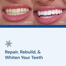 Snow Teeth Whitening Kit - Snow Teeth Whitening Serum and LED Mouthpiece Whitener, Formulated with Hydroxyapatite, Good for 2 Months - Wired Kit with 1 Wand by CozyNest Decor
