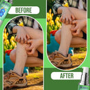 Dr. Nice’s Bye-Bye Bug Bite - Soothing Bug and Mosquito Bite Itch | All Natural | Kid Friendly Self Application | Hydrogel for Bites, Irritation, Skin Discomfort | Soothe Refresh Calm Cool (30 ML) by TinyTreasures Baby Boutique