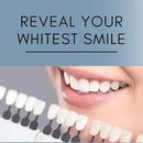 Teeth Whitening Gel Refill for Trays - Professional Strength 44% Carbamide Peroxide Formula - Fast & Effective Bleaching Solution for a Brighter Smile by CozyNest Decor