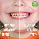 SprinJene Natural Kids Toothpaste, Watermelon | Natural Children’s Toothpaste for Cavity Protection | Fluoride Toothpaste for Toddlers | 1 Pack by CozyNest Decor