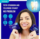 MySmile 7 Treatments Prefilled Teeth Whitening Trays Kit with 12% Hydrogen Peroxide Whiter Gel for Sensitive Tooth, Fast-Result Vegan Teeth Whitener Tooth Stain Remover, Mint Flavor by CozyNest Decor