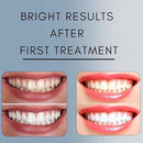 Teeth Whitening Gel Refill for Trays - Professional Strength 44% Carbamide Peroxide Formula - Fast & Effective Bleaching Solution for a Brighter Smile by CozyNest Decor