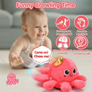 Baby Crawling & Walking Toys 6-12 Months Musical Octopus Plush Light up Stuffed Animal Dancing 1 Year Old Girl Gifts Music Sensory Walking Toy 0-6 7 8 9 Months Learning Newborn Baby Girl Birthday Gift by TinyTreasures Baby Boutique