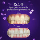 BURST Sensitive Teeth Friendly Whitening Kit | 3 Treatments with 12.5% Hydrogen Peroxide | Up to 3 Shades Whiter After First Use | Prefilled Gel Trays by CozyNest Decor