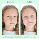 Face Moisturizer with Hyaluronic Acid Face Cream for Kids - Facial Cream & Gentle Moisturizer with Strawberry Extract & Vitamin E - Daily Facial Cream Moisturizer for Dry & Sensitive Skin 50ml by TinyTreasures Baby Boutique