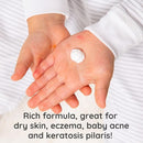 Bubbsi Whipped Coconut Oil Baby Lotion for Eczema, Dry Skin, Baby Acne, KP | Organic Coconut Oil, Shea Butter, Vitamin E | Light, Natural Scent | EU Compliant, Vegan (Refillable, 8oz) by TinyTreasures Baby Boutique