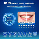 MySmile Teeth Whitening Kit for Sensitive Teeth with LED Light, 10 Min Non-Sensitive Fast Tooth Whitener, 3 Carbamide Peroxide Whitening Gel, Powerful Formula, Enamel Safe by CozyNest Decor