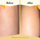 ECZEMA HONEY Soothing Body Wash - Daily Shower Gel & Eczema Treatment - Sensitive Skin Body Wash for Adults, Kids, & Babies - Body Cleanser for Eczema Relief (13 Oz) by TinyTreasures Baby Boutique
