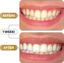 Lumineux Ultimate Whitening Kit Bundle - Contains Toothpaste, Mouthwash, Strips and Whitening Pen - Enamel Safe and Clinically Proven to Whiten Without The Sensitivity - Removes Coffee and Tea Stains by CozyNest Decor