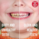SprinJene Natural Kids Toothpaste, Strawberry | Natural Children’s Toothpaste | Fluoride Free Toothpaste for Toddlers | 2 Pack by TinyTreasures Baby Boutique