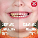 SprinJene Natural Kids Toothpaste, Strawberry | Natural Children’s Toothpaste | Fluoride Free Toothpaste for Toddlers | 4 Pack by CozyNest Decor