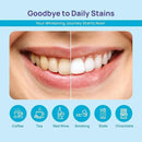 WhiteBite Pro Teeth Whitening Pens for Sensitive Teeth – 4 Pens Total (1 Blue Gel Pen for Sensitivity Relief), 35% Carbamide Peroxide Gel, Fast Whitening Results, Enamel-Safe, Travel-Friendly by CozyNest Decor