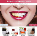 Professional Teeth Whitening Kit with 5 Teeth Whitening Gel, LED Accelerator Light & Rechargeable Design - Enamel Safe Gel, Custom Trays, Fast Results for Sensitive Teeth - Whitening Gel Kit by CozyNest Decor