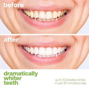 AquaSonic Professional Teeth Whitening Strips - Enamel Safe Teeth Whitening with Hydrogen Peroxide - Easy to Use, Non-Slip, Affordable & Effective (Spearmint) by CozyNest Decor