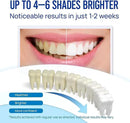 Teeth Whitening Pen Gel Kit: 35% Carbamide Peroxide Gel for Stain Removal - No Sensitivity with Remineralizing Pen for a Brighter Whiter Smile Mint by CozyNest Decor