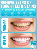 Oralfree Natural Teeth Whitening Strips - Sensitive Teeth Whitener - Enamel Safe Teeth Whitening Kit with Hydrogen Peroxide for Coffee, Wine, Tobacco, and Other Stains, 28 Strips (14 Treatment), Mint by CozyNest Decor