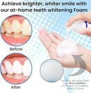 Swissklip Teeth Whitening Foam Toothpaste Also a Teeth Whitener in The Market I We Offer Best Teeth Whitening Products for Professional Teeth Whitening Kit (2) by CozyNest Decor