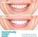 AquaSonic Professional Teeth Whitening Strips - Enamel Safe Teeth Whitening with Hydrogen Peroxide - Easy to Use, Non-Slip, Affordable & Effective (Unflavored) by CozyNest Decor