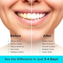 CARBON WHITE Teeth Whitening Powder - Natural Activated Coconut Charcoal Tooth Powder for Removing Stains & Discoloration - Helps Fight Tartar & Plaque, Freshens Breath - Tasteless, Odorless - 30g by CozyNest Decor